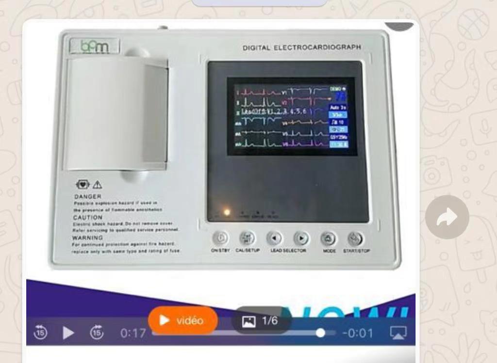 Color screen electrocardiograph